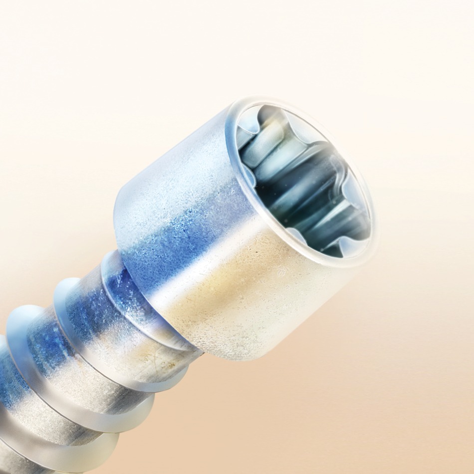 Key Considerations for Selecting Self-Tapping Screws - MTC Solutions